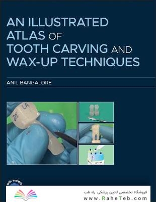 An Illustrated Atlas of Tooth Carving and Wax-Up Techniques