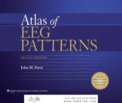 Atlas of EEG Patterns
