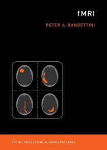 عکس fMRI (The MIT Press Essential Knowledge series)