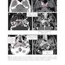 Target Volume Delineation and Field Setup : A Practical Guide for Conformal and Intensity-Modulated Radiation Therapy