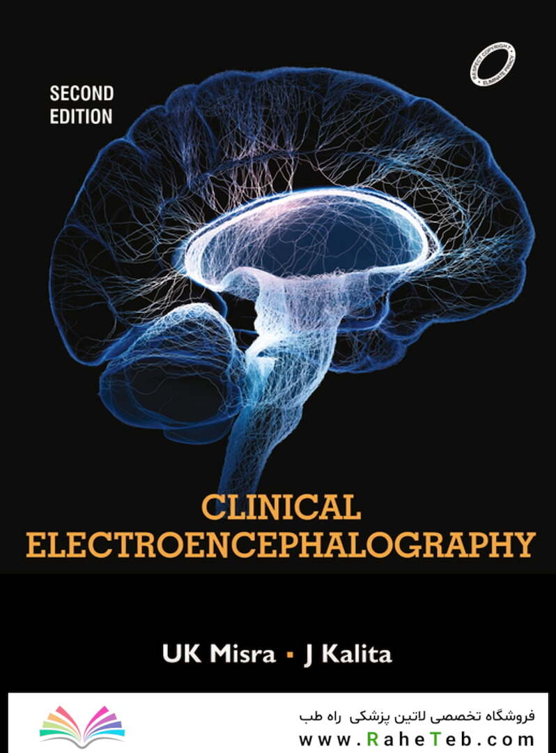 Clinical Electroencephalography, 2nd Edition