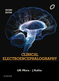 عکس Clinical Electroencephalography, 2nd Edition