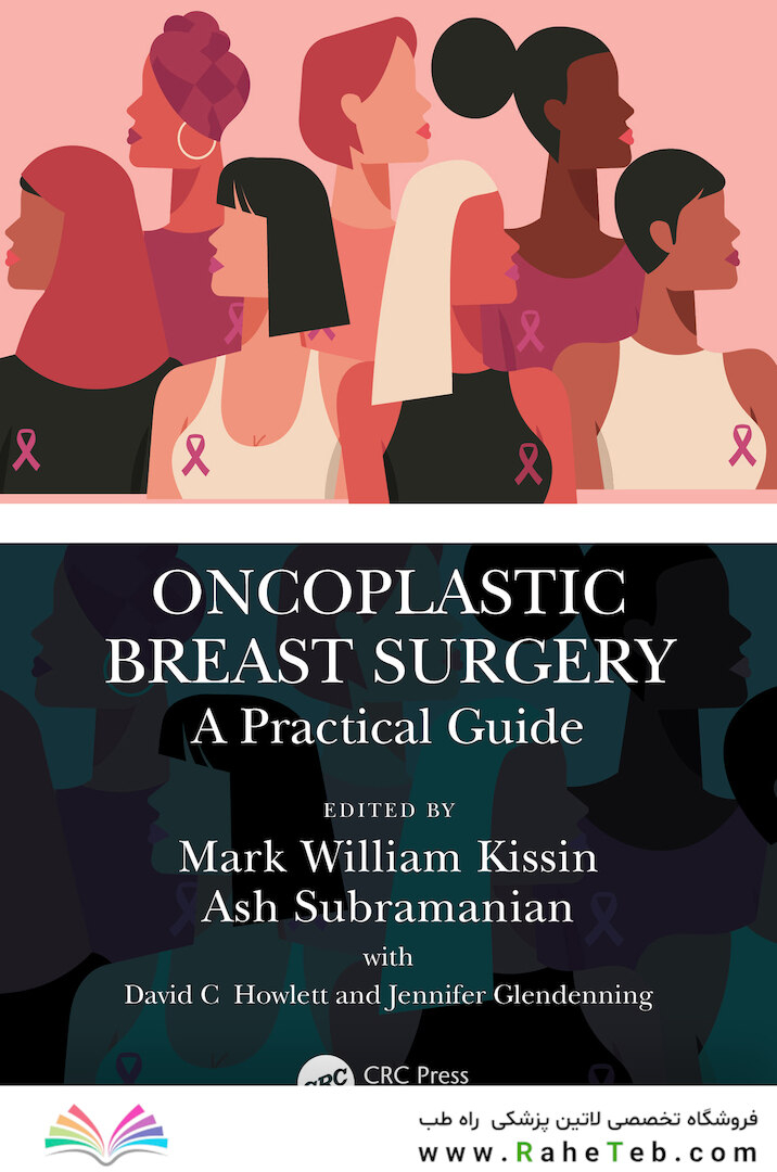 Oncoplastic Breast Surgery: A Practical Guide 1st Edicion