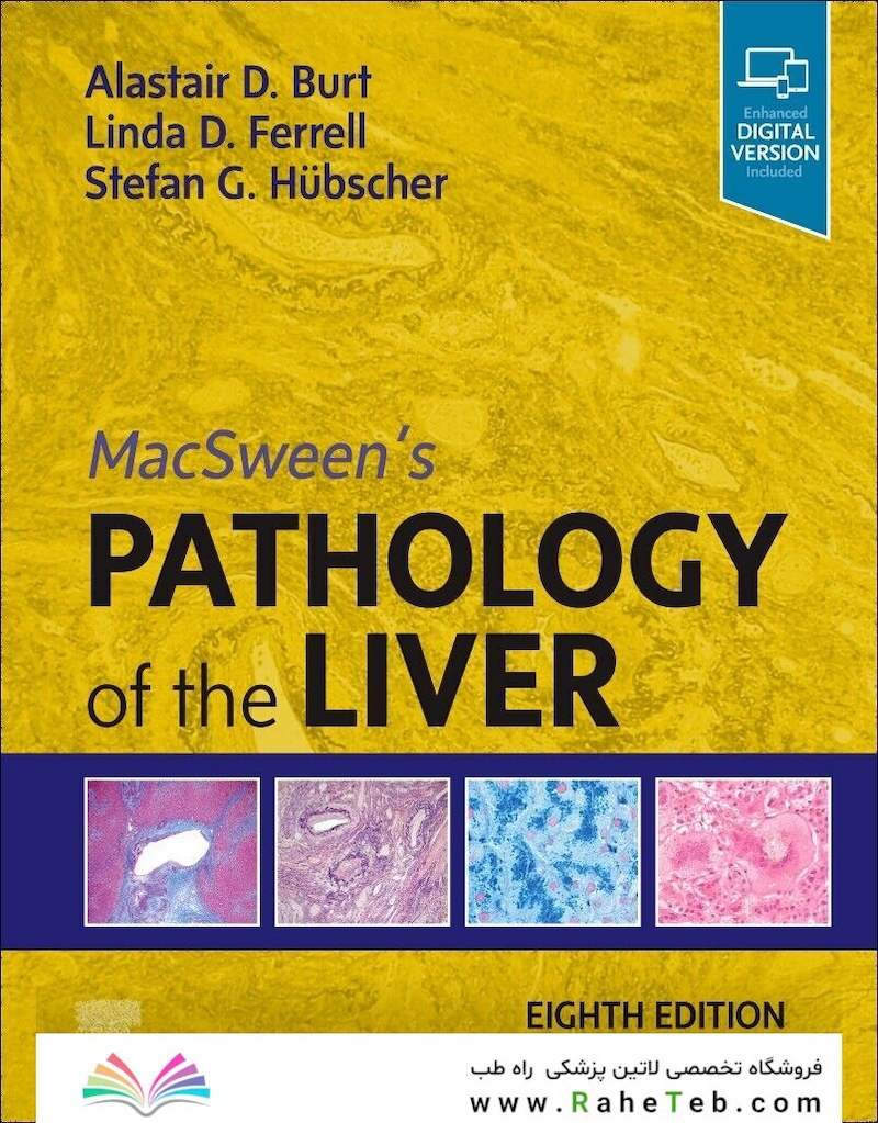 MacSween
