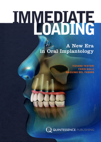 عکس Immediate Loading: A New Era in Oral Implantology 1st Edicion