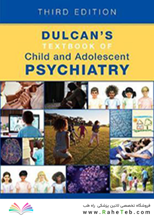 Dulcan
