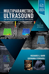 عکس Multiparametric Ultrasound for the Assessment of Diffuse Liver Disease : A Practical Approach 2023