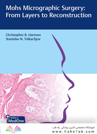 Mohs Micrographic Surgery: From Layers to Reconstruction 1st Edicion 2023