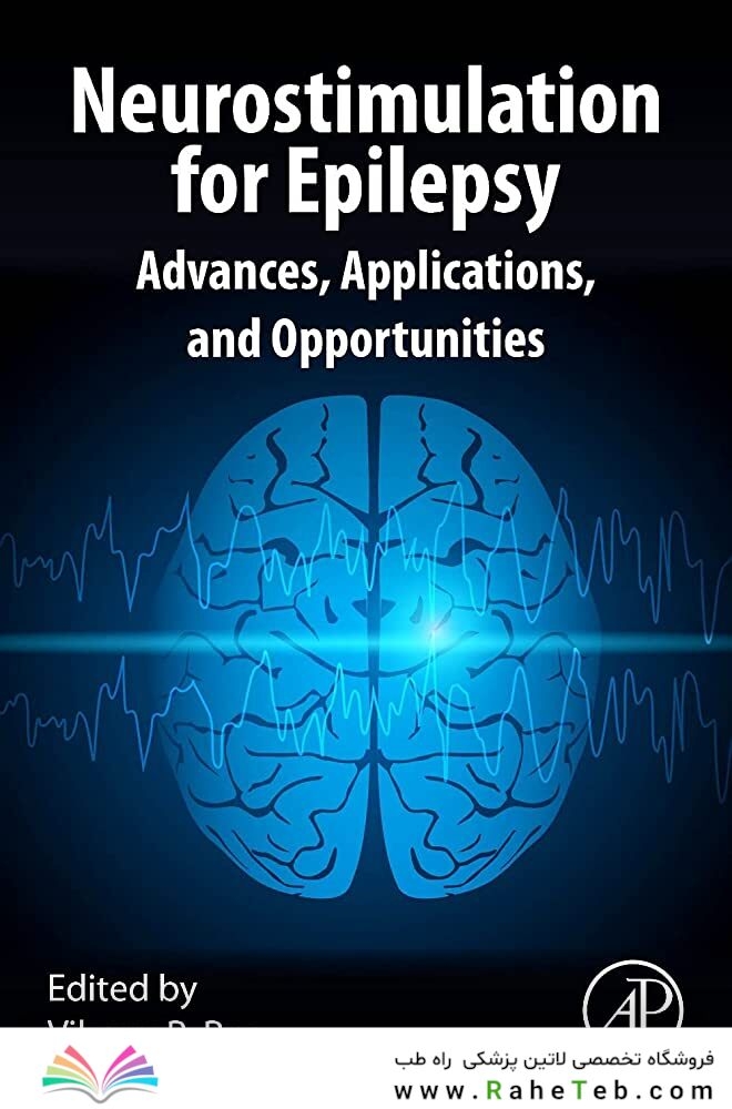 Neurostimulation for Epilepsy: Advances, Applications and Opportunities 2023