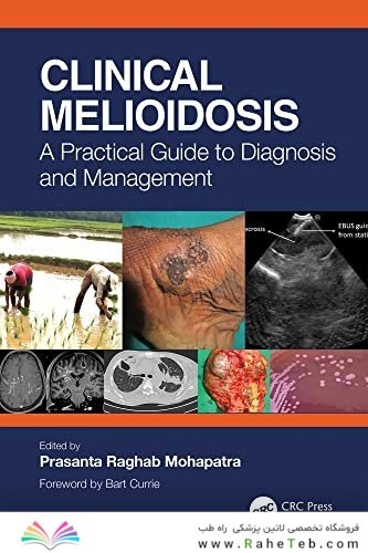 Clinical Melioidosis: A Practical Guide to Diagnosis and Management 1st Edition