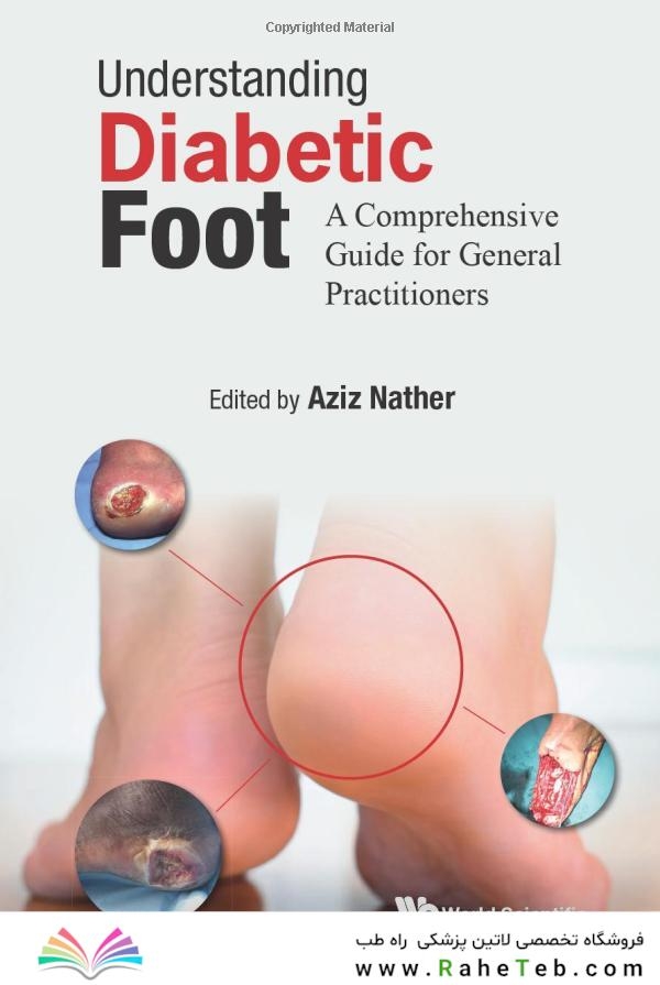 Understanding Diabetic Foot: A Comprehensive Guide For General Practitioners