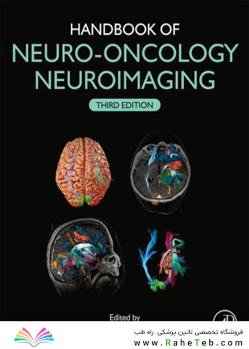 Handbook of Neuro-Oncology Neuroimaging 3rd Edition