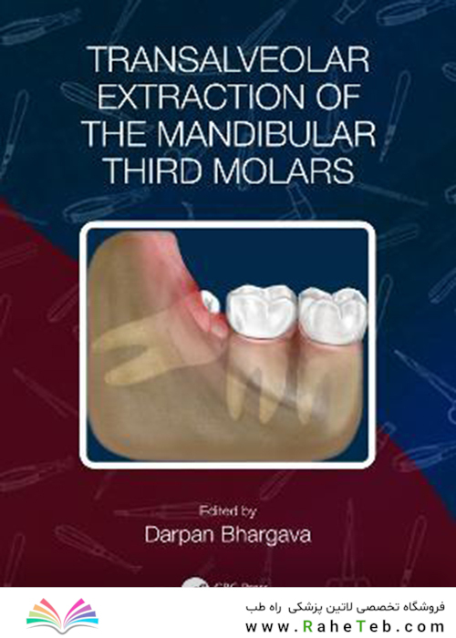 Transalveolar Extraction of the Mandibular Third Molars