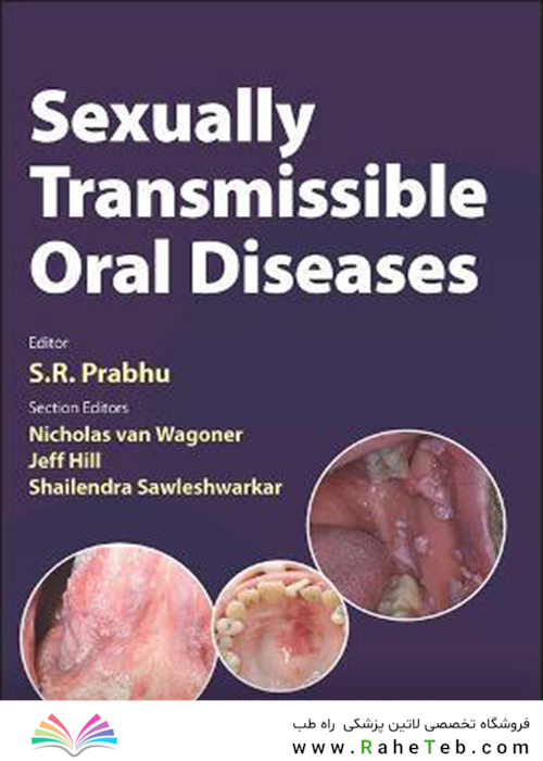Sexually Transmissible Oral Diseases 1st Edition, Kindle Edition