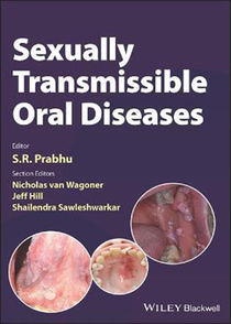 عکس Sexually Transmissible Oral Diseases 1st Edition, Kindle Edition