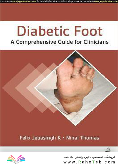 Diabetic Foot : A Comprehensive Guide for Clinicians 1st Edition, Kindle Edition