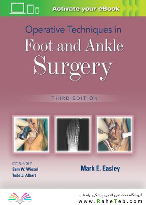 Operative Techniques in Foot and Ankle Surgery Third Edition