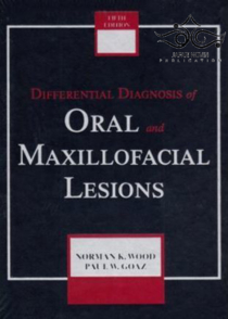 عکس Differential Diagnosis of Oral and Maxillofacial Lesions 5th Edition1997 تشخیص افتراقی ضایعات دهانی و فک و صورت