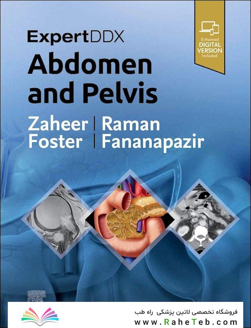 ExpertDDx: Abdomen and Pelvis, 3rd Edition 2023