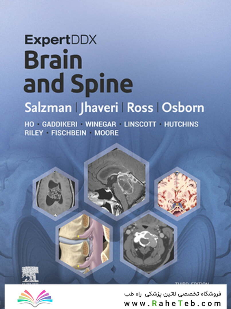 ExpertDDx: Brain and Spine 3rd Edicion 2024