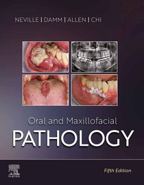 عکس Oral and Maxillofacial Pathology 5th Edicion 2024