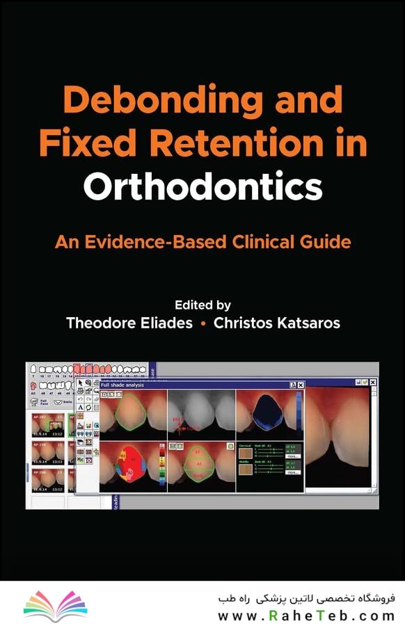 Debonding and Fixed Retention in Orthodontics: An Evidence-Based Clinical Guide 1st Edicion 2024