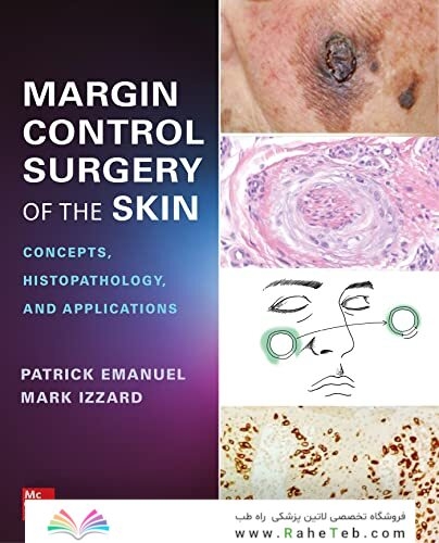 Margin Control Surgery of the Skin: Concepts, Histopathology, and Applications 1st Edicion 2023