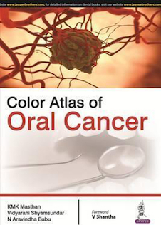 عکس Color Atlas of Oral Cancer