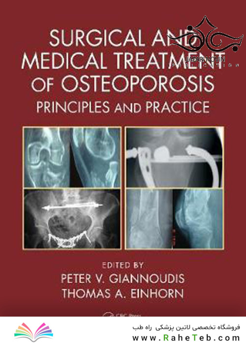 Surgical and Medical Treatment of Osteoporosis: Principles and Practice 1st Edition درمان جراحی و پزشکی پوکی استخوان: اصول و عمل