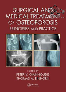 عکس Surgical and Medical Treatment of Osteoporosis: Principles and Practice 1st Edition درمان جراحی و پزشکی پوکی استخوان: اصول و عمل