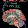 Neuroanatomy through Clinical Cases, 2nd Edition2010 عصب کشی از طریق موارد بالینی