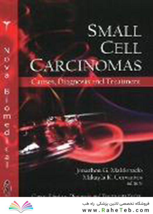 Small Cell Carcinomas : Causes, Diagnosis & Treatment2010سرطان سلولهای کوچک: علل ، تشخیص و درمان