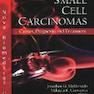 Small Cell Carcinomas : Causes, Diagnosis & Treatment2010سرطان سلولهای کوچک: علل ، تشخیص و درمان