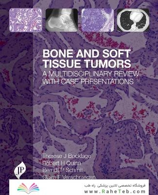 Bone and Soft Tissue Tumors : A Multidisciplinary Review with Case Presentationsتومورهای بافت استخوانی و نرم: یک بررسی چند رشته ای با ارائه موارد