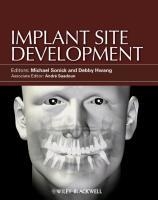 عکس Implant Site Development