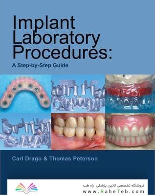 Implant Laboratory Procedures : A Step-by-Step Guide
