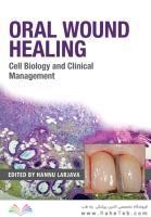 Oral Wound Healing