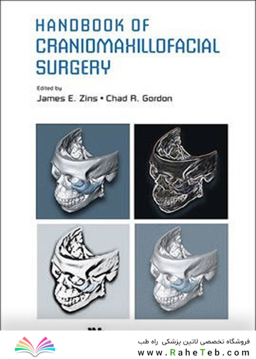 Handbook Of Craniomaxillofacial Surgery