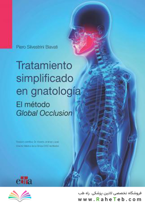 Oclusión global : tratamiento simplificado en gnatología