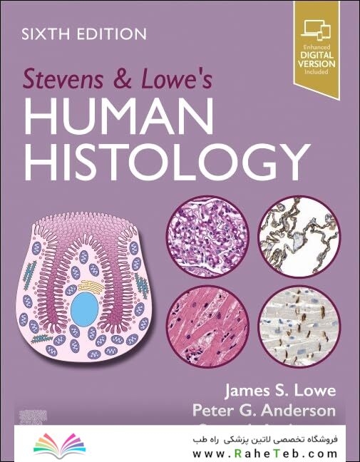 Stevens & Lowe