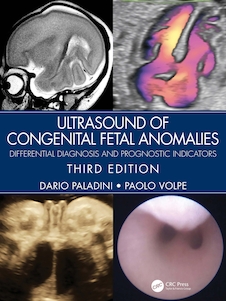 عکس Ultrasound of Congenital Fetal Anomalies: Differential Diagnosis and Prognostic Indicators 3rd Edition 2024