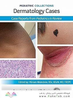 Pediatric Collections: Dermatology Cases: Case Reports from Pediatrics in Review
