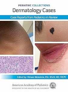عکس Pediatric Collections: Dermatology Cases: Case Reports from Pediatrics in Review