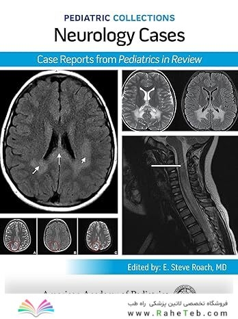 Pediatric Collections: Neurology Cases: Case Reports from Pediatrics in Review