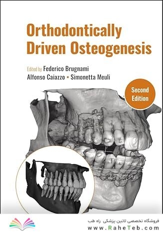 Orthodontically Driven Osteogenesis 2nd Edition