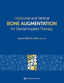 عکس Horizontal and Vertical Bone Augmentation for Dental Implant Therapy