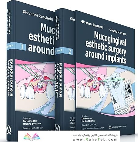 Mucogingival Esthetic Surgery Around Implants 1st Edition
