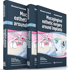 عکس Mucogingival Esthetic Surgery Around Implants 1st Edition