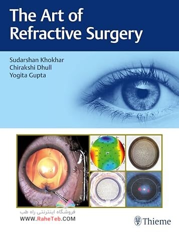 The Art of Refractive Surgery 1st Edition