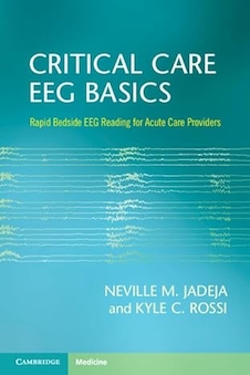 عکس Critical Care EEG Basics: Rapid Bedside EEG Reading for Acute Care Providers